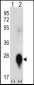 CLEC3B Antibody (Center)